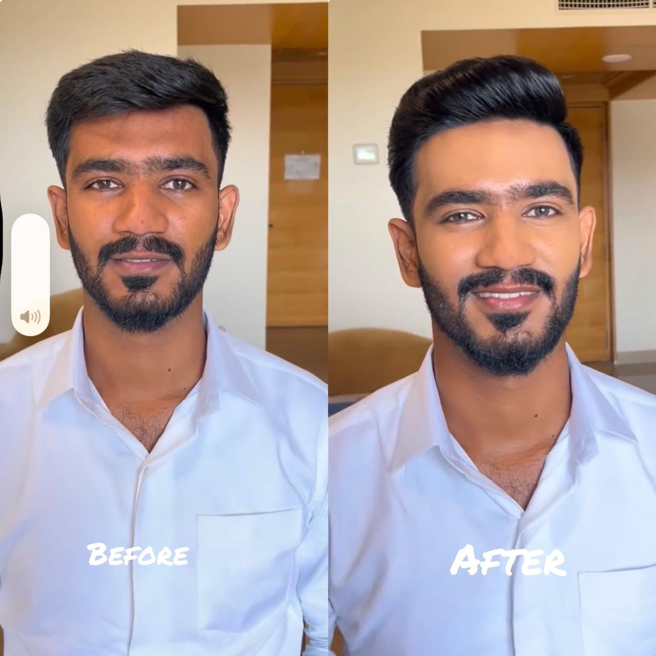 Groom Makeup Before After Chennai
